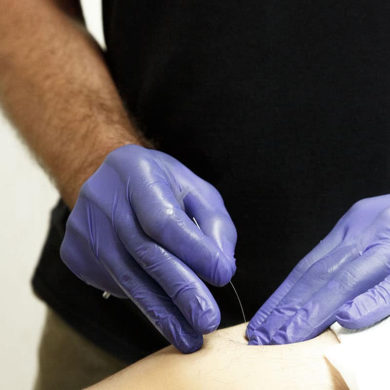 fisioterapia-marzagan